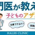 アザ・シミ治療は乳児から大人まで可能です